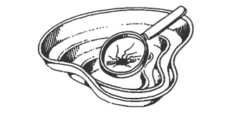 Kontrolle Beschaedigungen